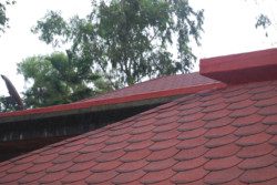 Shingles